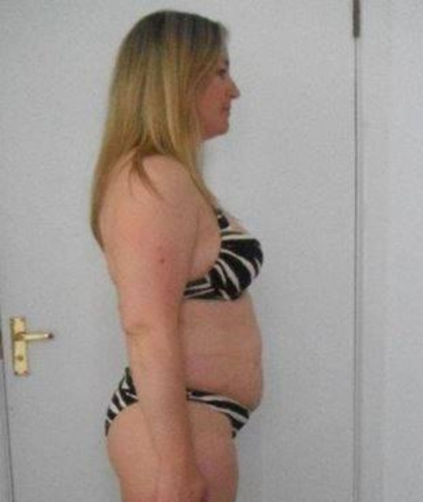 Antes